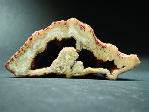 Amygdale cross section