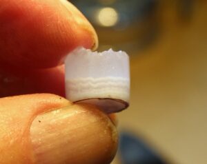 basanite and brazilian agate doublet