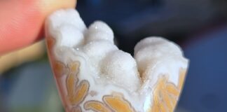 Youngite: How to Cut and Polish Cabbed youngite specimen with an exposed druzy top.